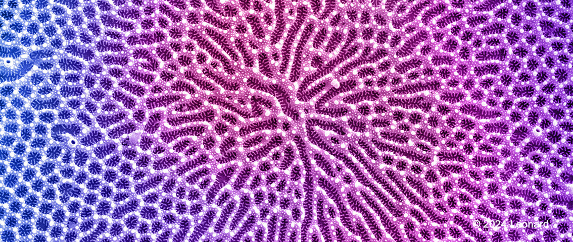 Electron microscope image of embryonic stem cells