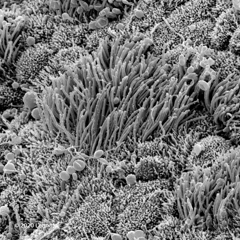Electron microscope image of COVID-19 coronavirus particles