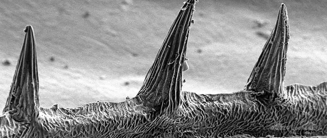 Electron microscope image of embryonic stem cells