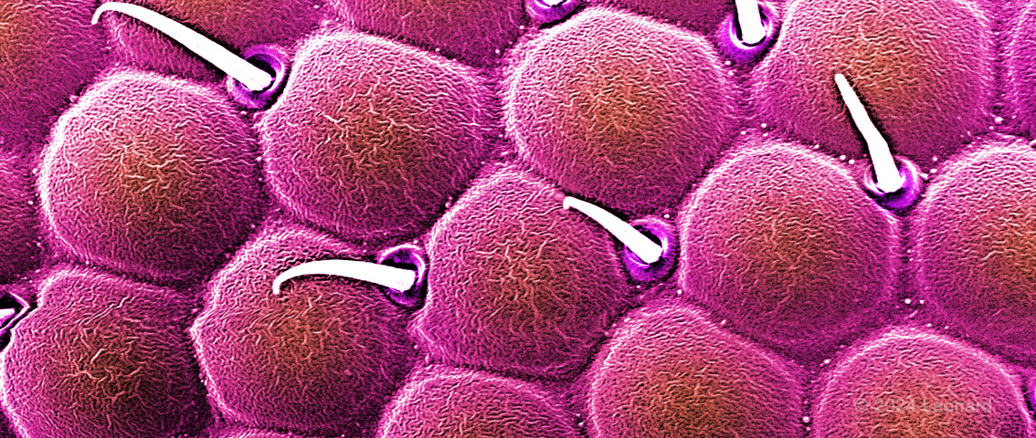 Electron microscope image of embryonic stem cells