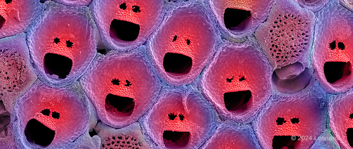 Electron microscope image of embryonic stem cells