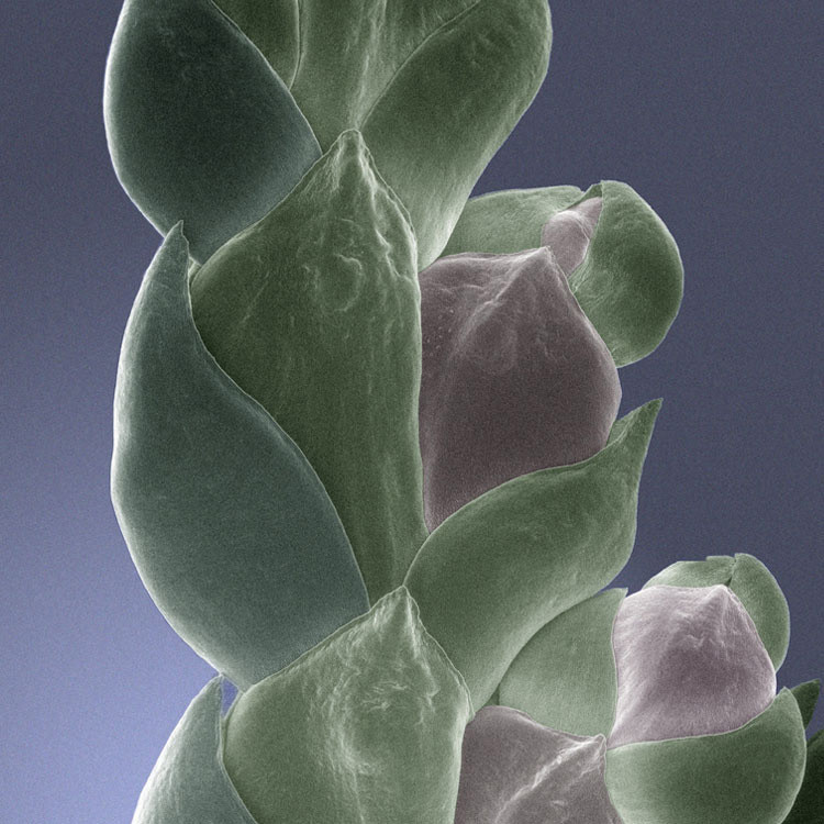 Fine art electron microscope image combining science and art