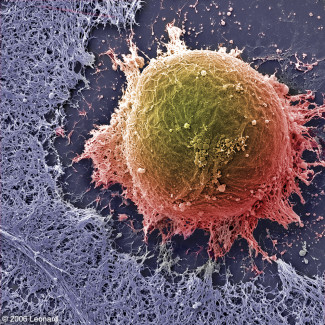 Electron microscope image of embryonic stem cells