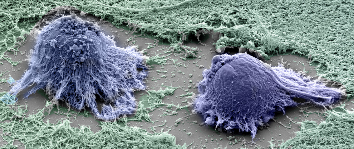 Electron microscope image of embryonic stem cells