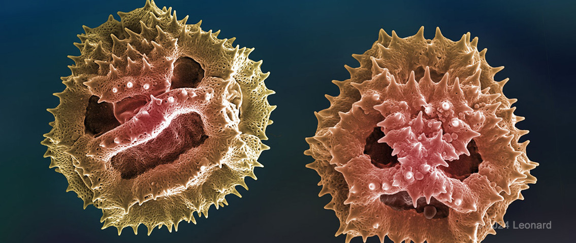 Electron microscope image of embryonic stem cells
