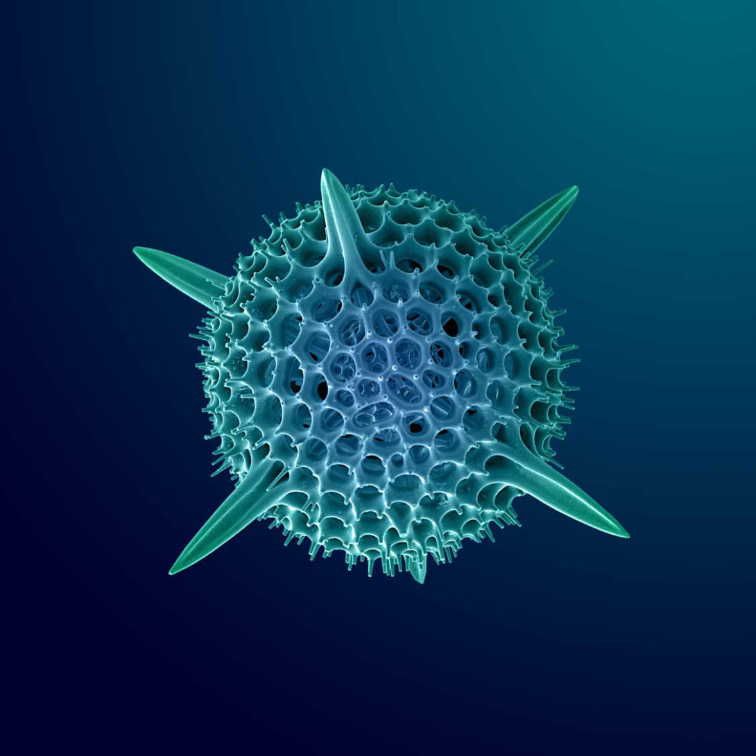 Electron microscope image of marine microorganisms