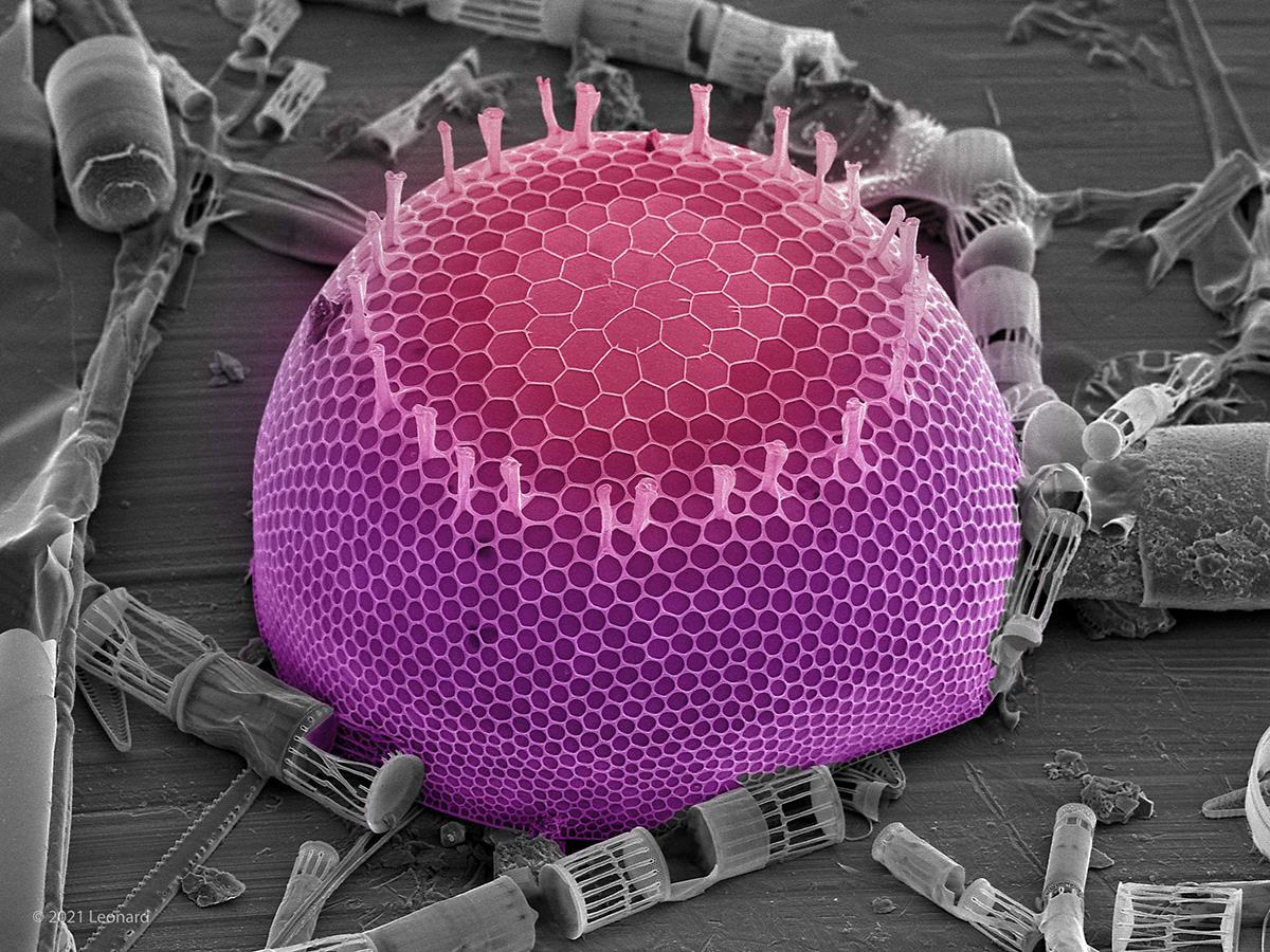 Hudson River Diatoms