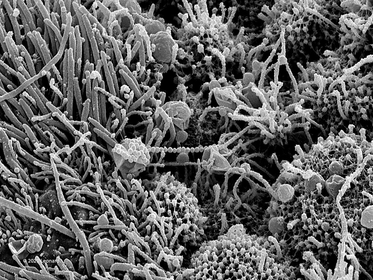 COVID Infected Nasal Epithelial Tissue