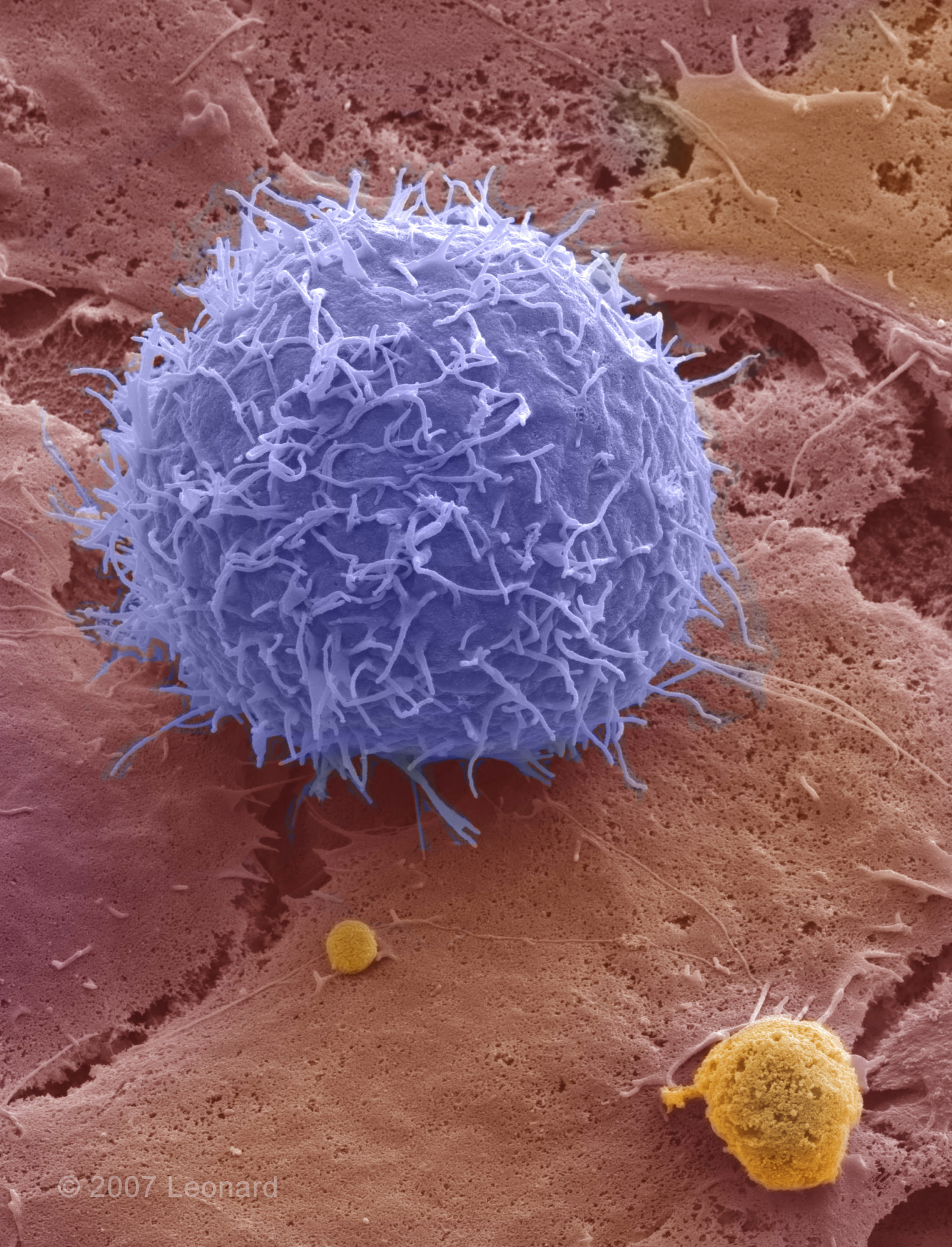 Lymphocyte
