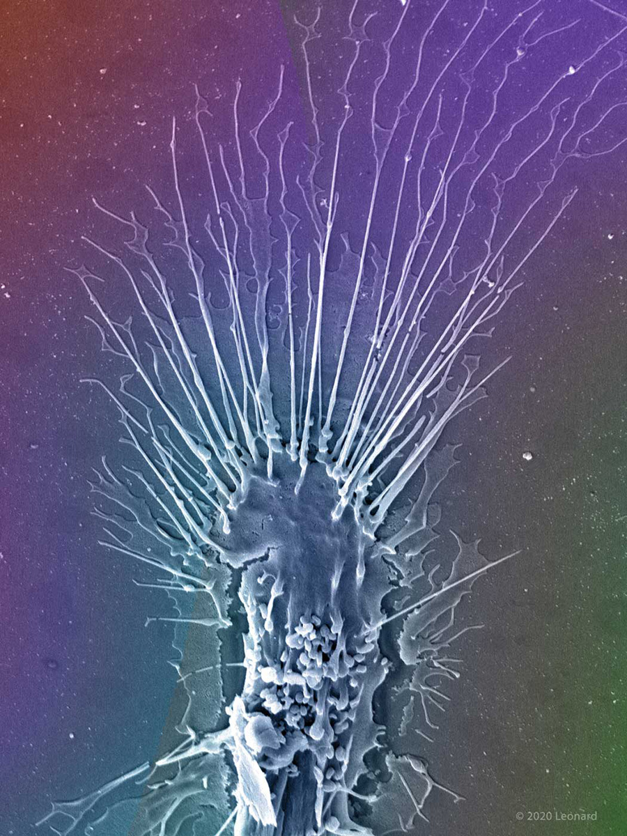 Monocyte-Derived Dendritic Cell Interacting with Talc