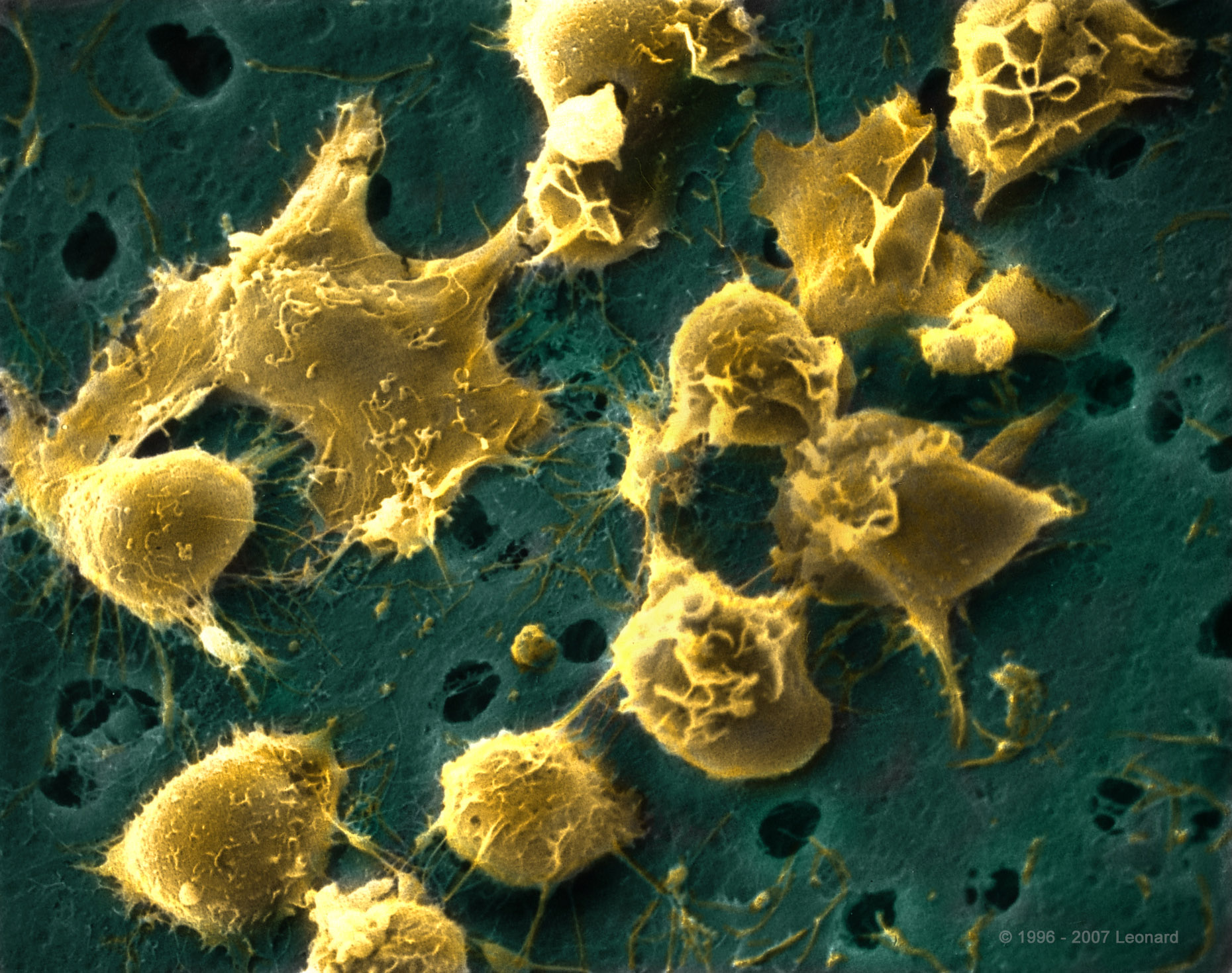 Hematopoietic Bone Marrow Stem Cells