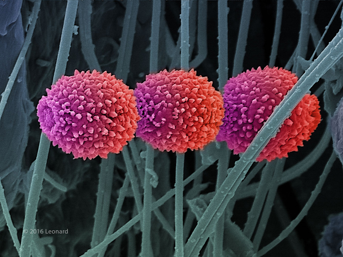 Mold Spores in a Book