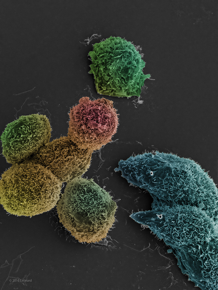 Standoff between cells of different stages.