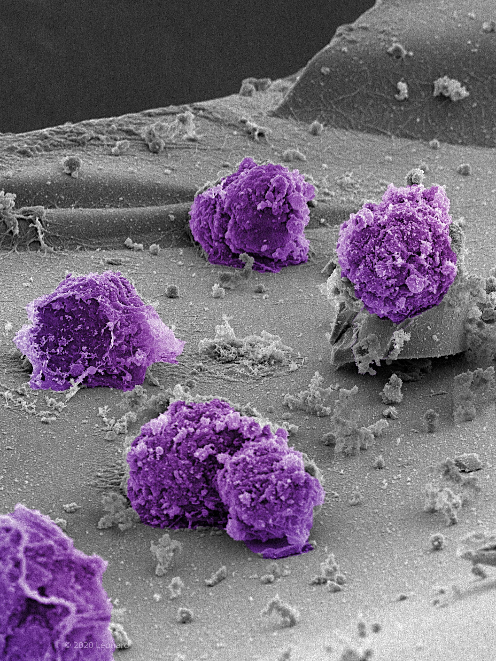 Cord Blood Stem Cells