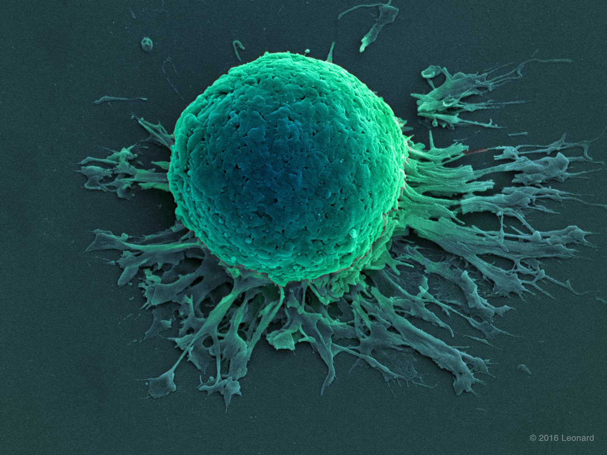 Dendritic Cell