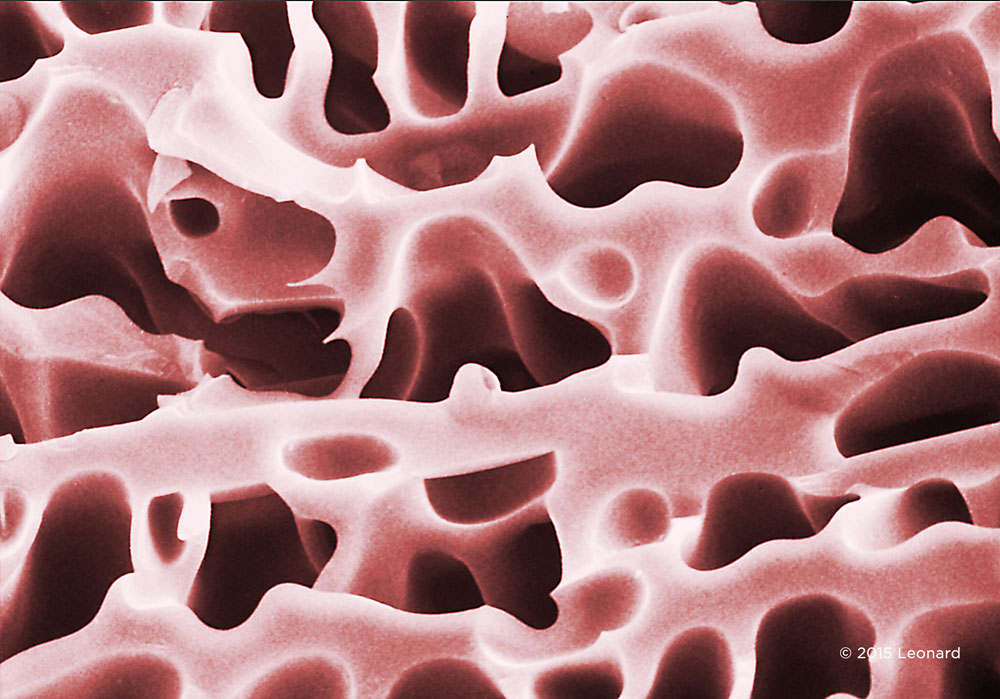 Lyophilized Follical Dtimulating Hormone (FSH)