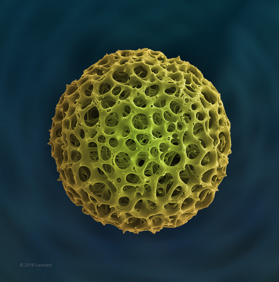 Acrosphaera Radiolarian