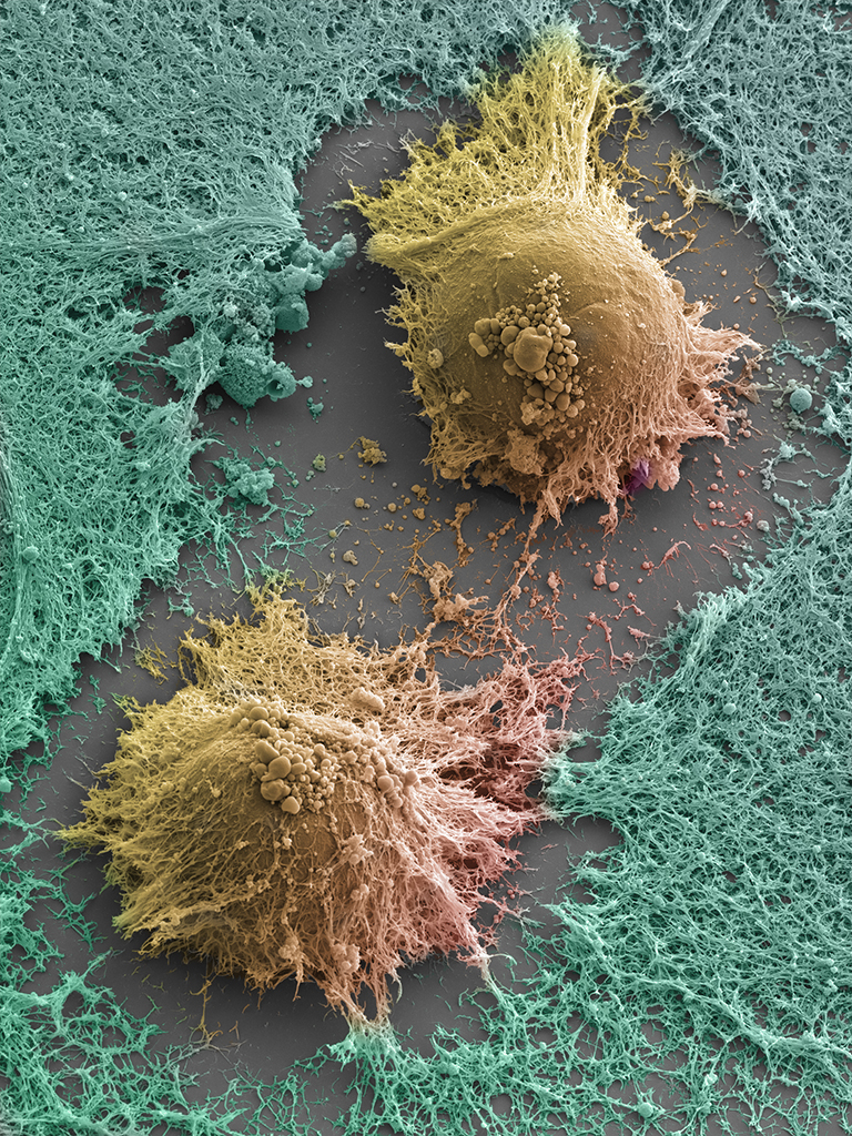 Human Embryonic Stem Cell