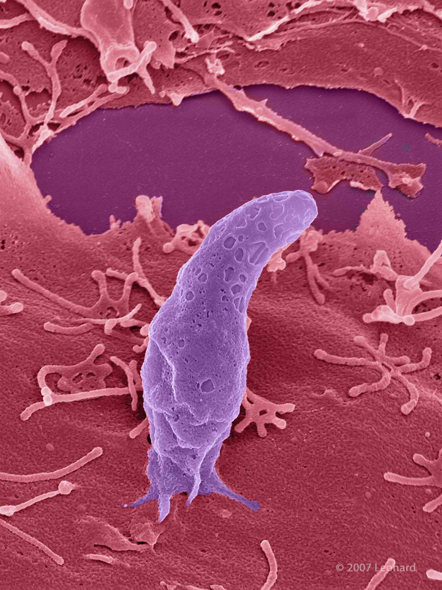Toxoplasma gondii parasite