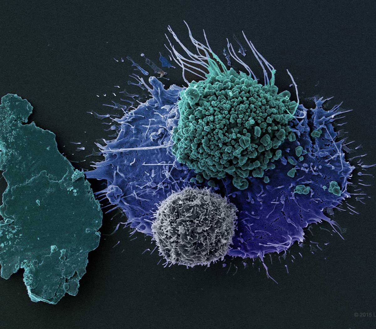 Breast Cancer Cells (BT549 Triple Negative)