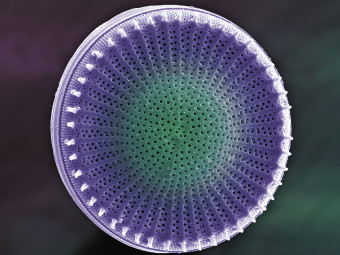 Pennate Diatom from Hudson River in New York City
