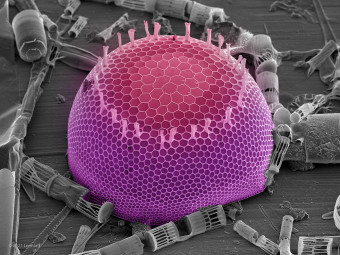 Hudson River Diatoms