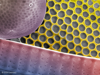 Hudson River Diatoms