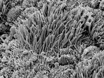 COVID-19 Infected Nasal Epithelial Tissue