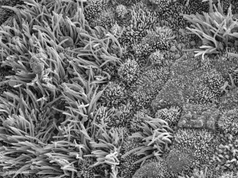 COVID Infected Nasal Epithelial Tissue