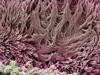 COVID-19 Infected Nasal Epithelial Tissue