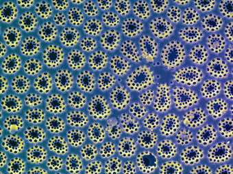 Electron micrograph of pattern on diatom.