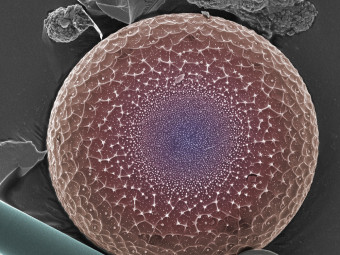 Myriad of Hudson River Diatoms