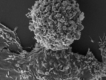 Breast Cancer Cells (BT549 Triple Negative)