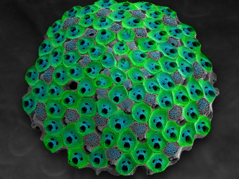 Bryozoan from Australia