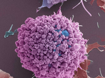 Breast Cancer Cells (BT549 Triple Negative)