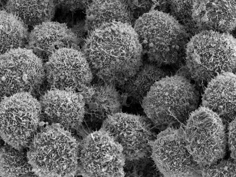 Breast Cancer Cells (HER-2 Positive)