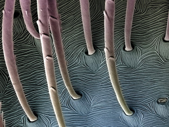 Landscape on a Spider's Body