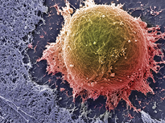 Human Embryonic Stem Cell Photo HES_01_15