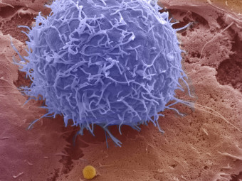 Lymphocyte