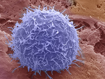 General Biology, Lymphocyte Image