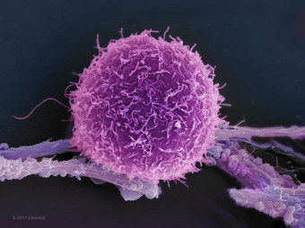 Melanoma Cell