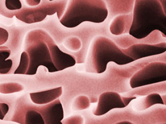 Subjects that look abstract