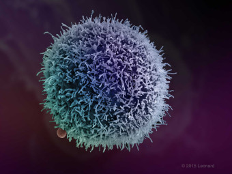 HER2-Positive Breast Cancer Cells