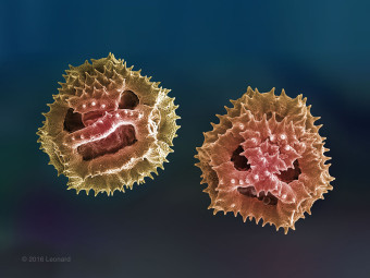 Angry Pollen from Central Park, NY