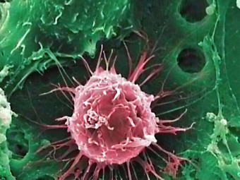 Time Magazine Stem Cell Cover