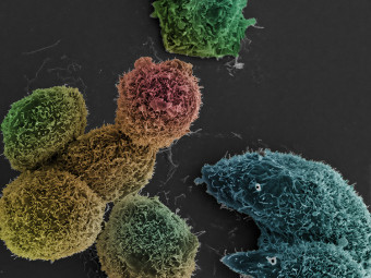 Standoff between cells of different stages.