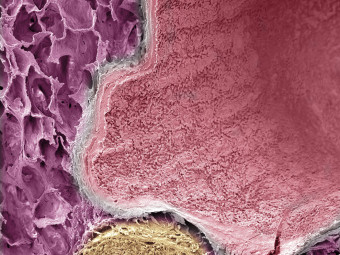 Lung tissue showing airsacks (alveoli) brachial and blood vessel