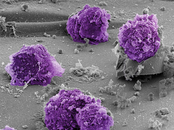 Cord Blood Stem Cells