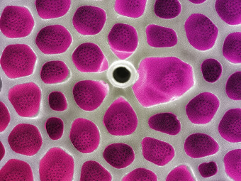 Honeycomb-like Pattern on Hudson River Diatom