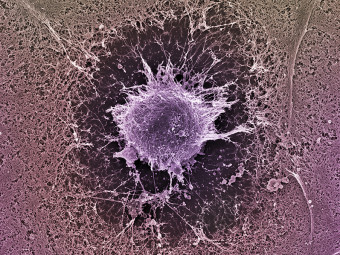 Human Embryonic Stem Cell
